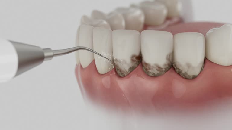Reliable Wisdom Tooth Removal contractor in Charles County County, MD by Dentist Open Now